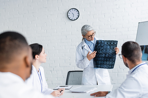 mature asian physician showing head mri scan to blurred multicultural doctors