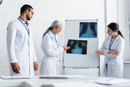 mature asian doctor pointing at lungs x-ray on flip chart near young colleagues