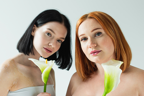 Plus size and woman with vitiligo holding calla lilies isolated on grey