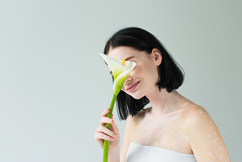 Woman with vitiligo covering face with calla lily isolated on grey