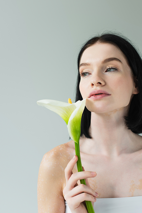 Woman with vitiligo holding calla flower and looking away isolated on grey