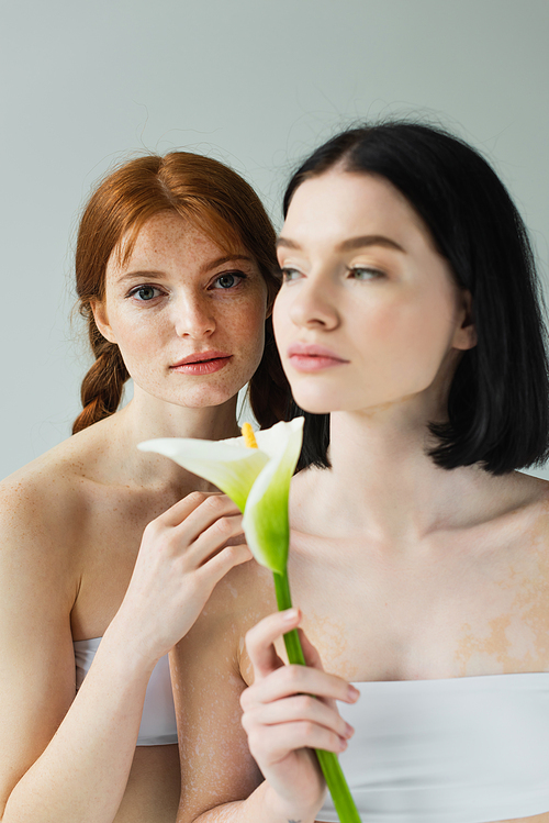 Freckled woman hugging friend with vitiligo and flower on blurred foreground isolated on grey