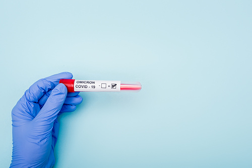 partial view of doctor holding positive covid-19 omicron variant test on blue background