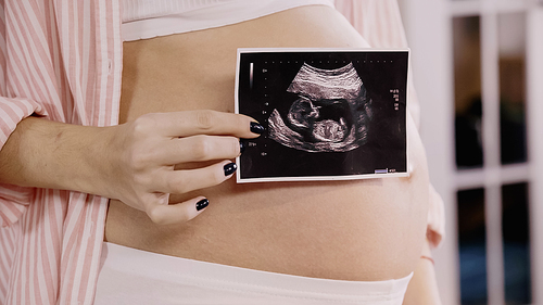 Cropped view of pregnant woman holding ultrasound scan of baby near belly