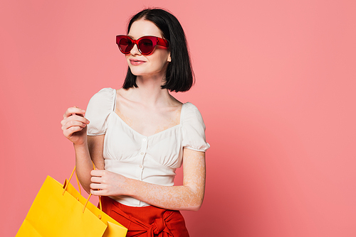Stylish woman with vitiligo holding shopping bag isolated on pink