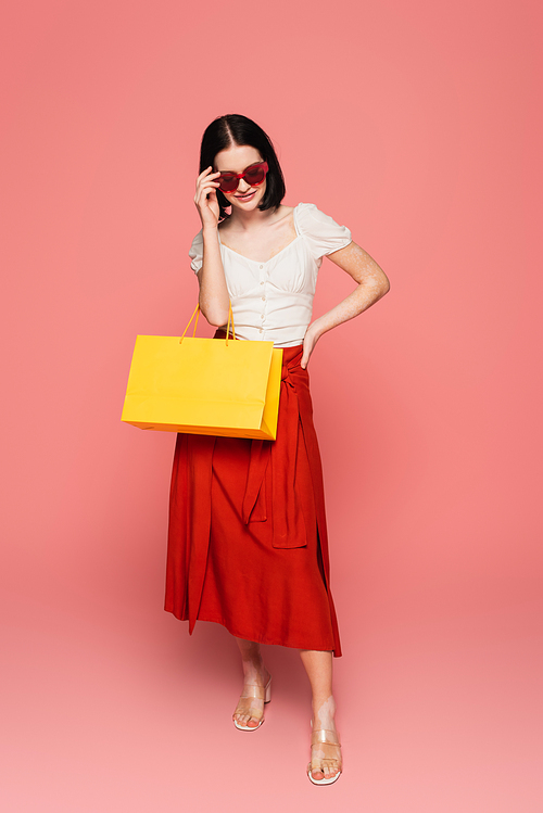 Pretty woman with vitiligo holding sunglasses and shopping bag on pink background