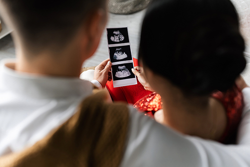 back view of blurred couple holding ultrasound scan with pregnancy confirmation