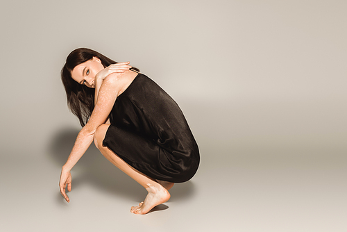 barefoot model with vitiligo posing in dress on grey background with shadow