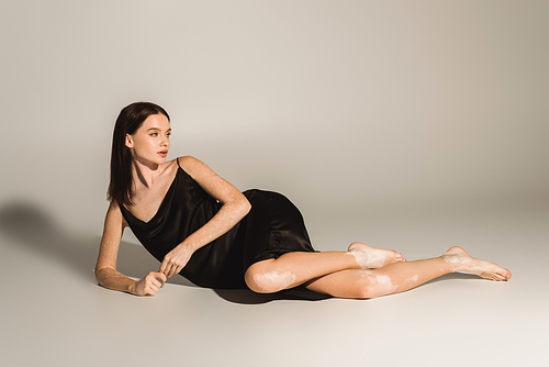 Sensual woman with vitiligo in black dress lying on grey background with shadow