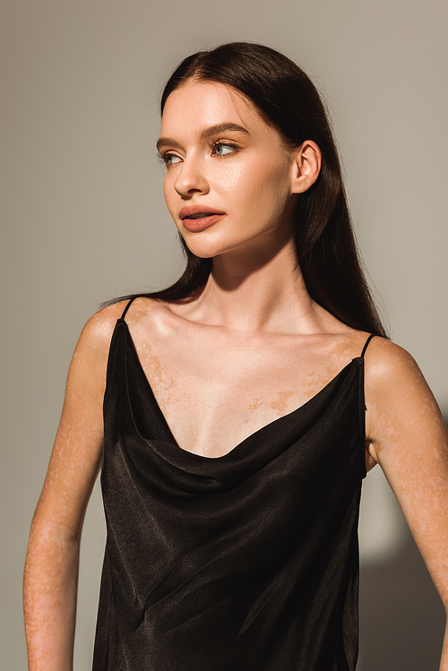 Pretty woman with vitiligo looking away while posing on grey background