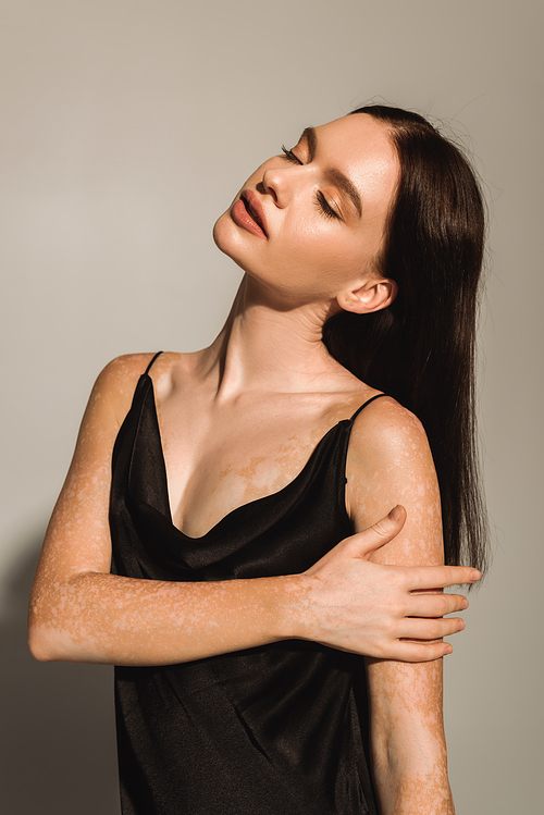 Pretty woman with vitiligo closing eyes and touching arm on grey background