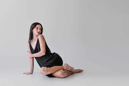 Sensual woman with vitiligo posing in dress while sitting on grey background