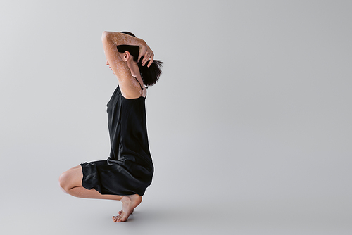 Barefoot woman with vitiligo touching hair on grey background