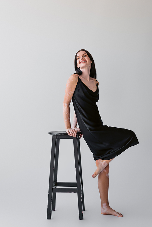 Smiling woman with vitiligo posing near chair on grey background