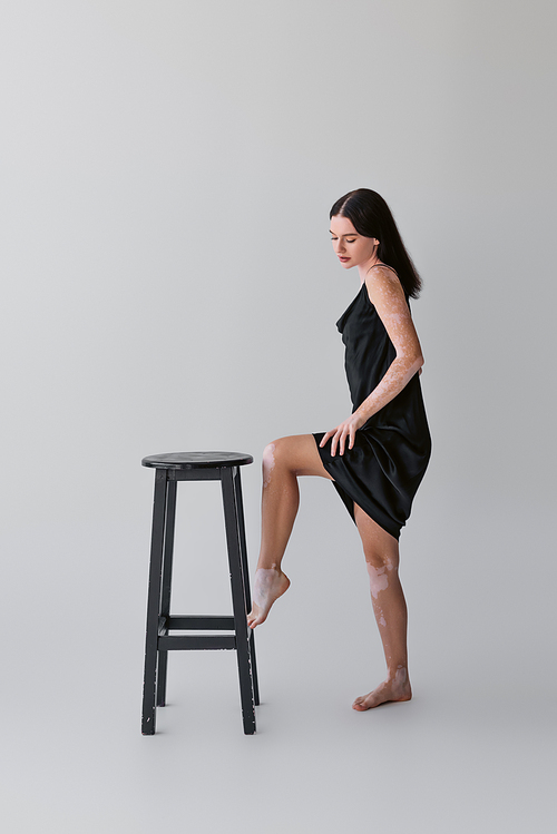 Pretty barefoot model with vitiligo standing near chair on grey background