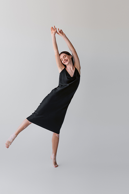 Full length of cheerful woman with vitiligo raising hands while posing in silk dress on grey background