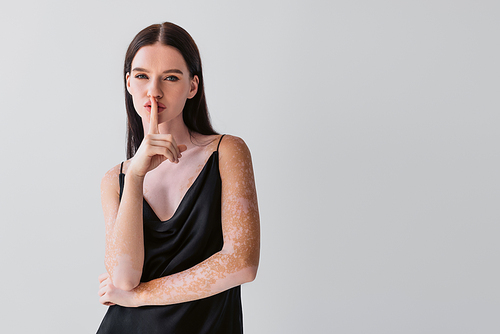 Stylish young woman with vitiligo showing secret gesture isolated on grey