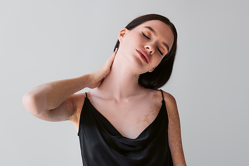 Young woman with vitiligo touching neck and closing eyes isolated on grey