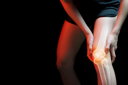 Medical concept, Woman suffering  with knee painful - skeleton x-ray,