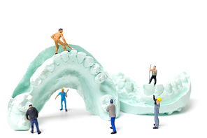 Miniature Worker team is filing fake teeth and placing them in a denture made with plaster. Dental prosthesis laboratory.