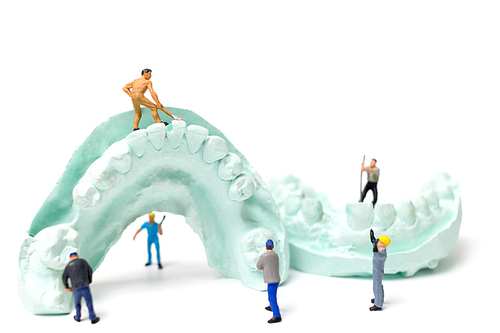 Miniature Worker team is filing fake teeth and placing them in a denture made with plaster. Dental prosthesis laboratory.