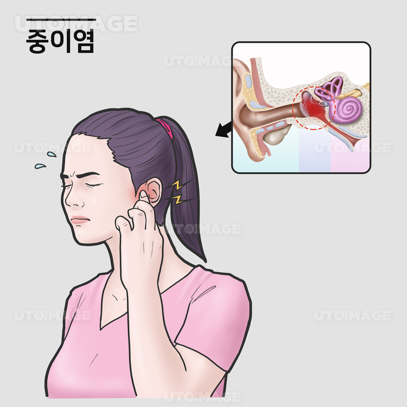 유토이미지 | 중이염 증상 환자 유토이미지 | 중이염 증상 환자