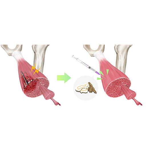 근육파열 약침 한의학치료 효과 일러스트