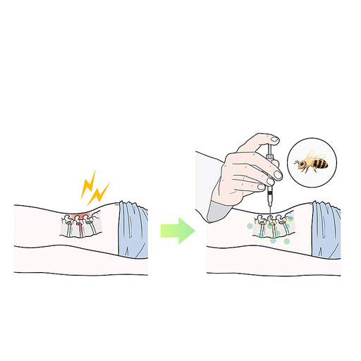 봉침 진통 항염 한의학치료 효과 일러스트