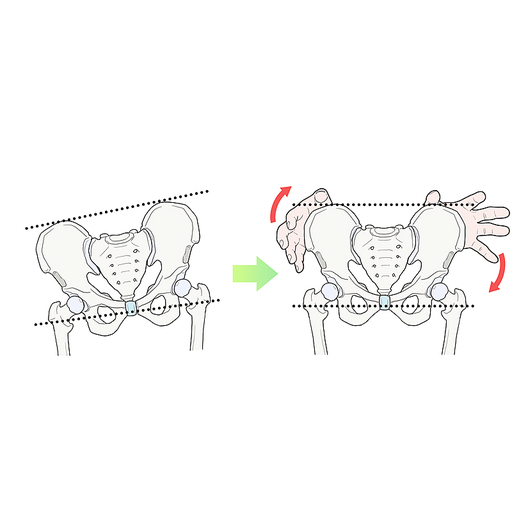 골반교정 추나욥법 한의학치료 효과 일러스트