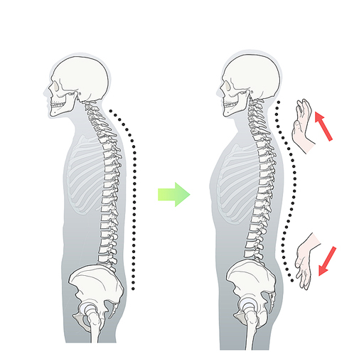 추나요법 척추만곡 교정 한의학치료 효과 일러스트