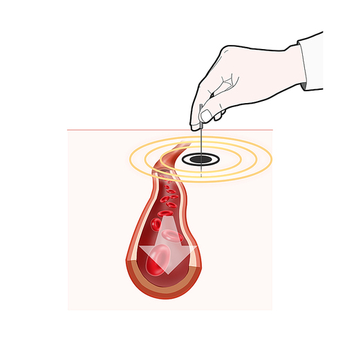 침 혈액순환 한의학 치료 효과 기전 설명 일러스트