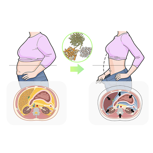 내장지방 한약 비만 다이어트 한의학 치료 효과 기전 설명 일러스트