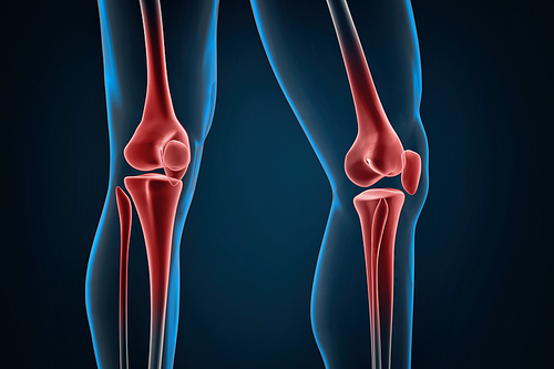 Injured knees close-up. 3D illustration. Contains clipping path