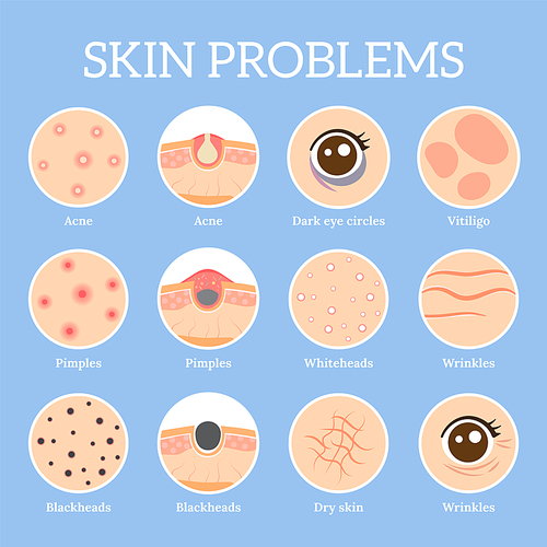 Skin problems. Ages wrinkles problem, face skin infection treatment and dark circles under eyes or black head pores, acne problems. Dermatology health vector icons set