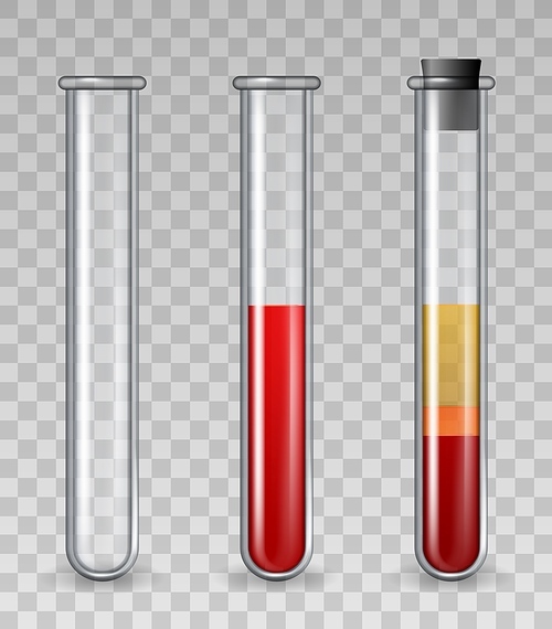 Test tubes with blood. Realistic glass medical tube empty, filled with red cells, platelet rich plasma. PRP dermatology therapy vector set. Illustration pharmacology and therapy scientific chemistry