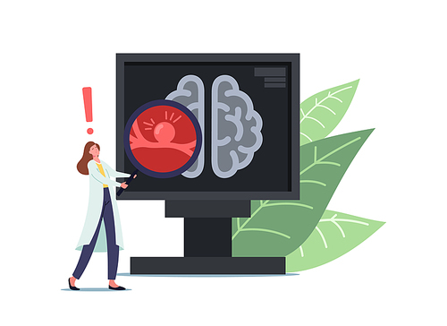 Tiny Doctor Female Character in White Medical Robe Holding Huge Magnifier at Pc Screen with Tomography of Human Brain with Aneurysm Bulg on Vessel Wall, Danger Sickness. Cartoon Vector Illustration