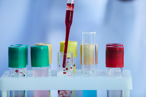 Close-up of blood samples in test tubes in the laboratory