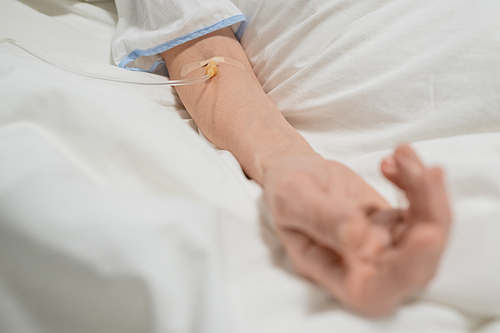 Close-up of senior woman lying in bed with drip in her arm, she is under the anesthesia