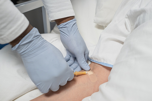 Close-up of doctor in protective gloves putting anesthesia n the arm of a patient before the operation